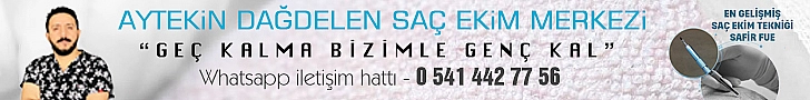 Aytekin Dağdelen Saç Ekim Merkezi - En Gelişmiş Saç Ekim Tekniği 'Safir Fue' Aytekin Dağdelen Saç Ekim Merkezi - En Gelişmiş Saç Ekim Tekniği 'Safir Fue'