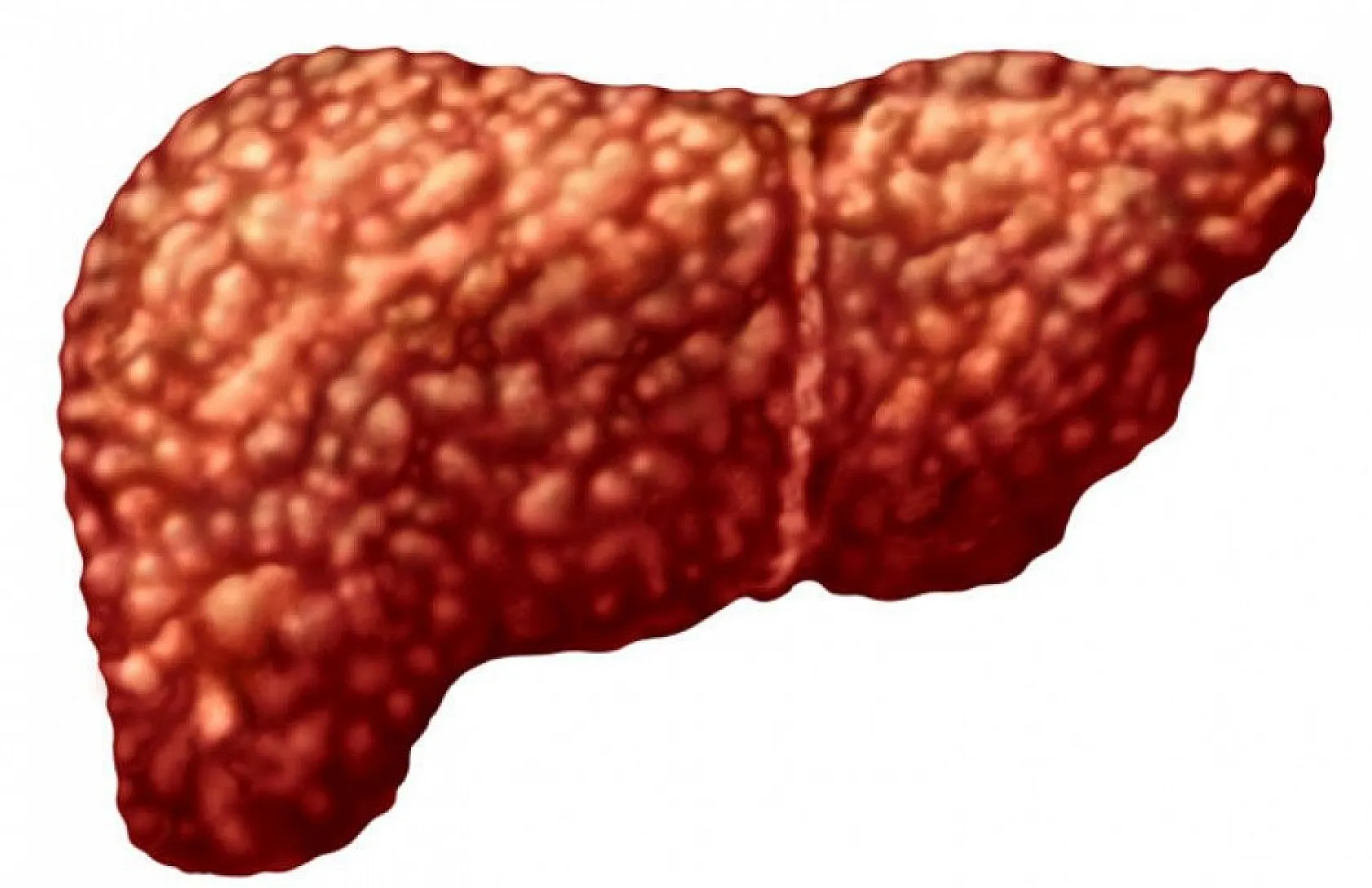 Karaciğer yağlanmasına dikkat!