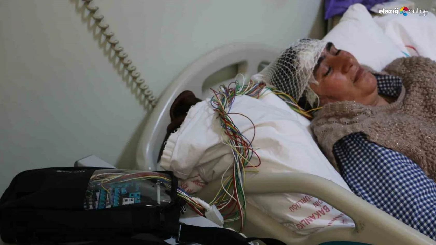 Diyarbakır'da epilepsi hastalarına video EEG sistemi ile tanı konuluyor