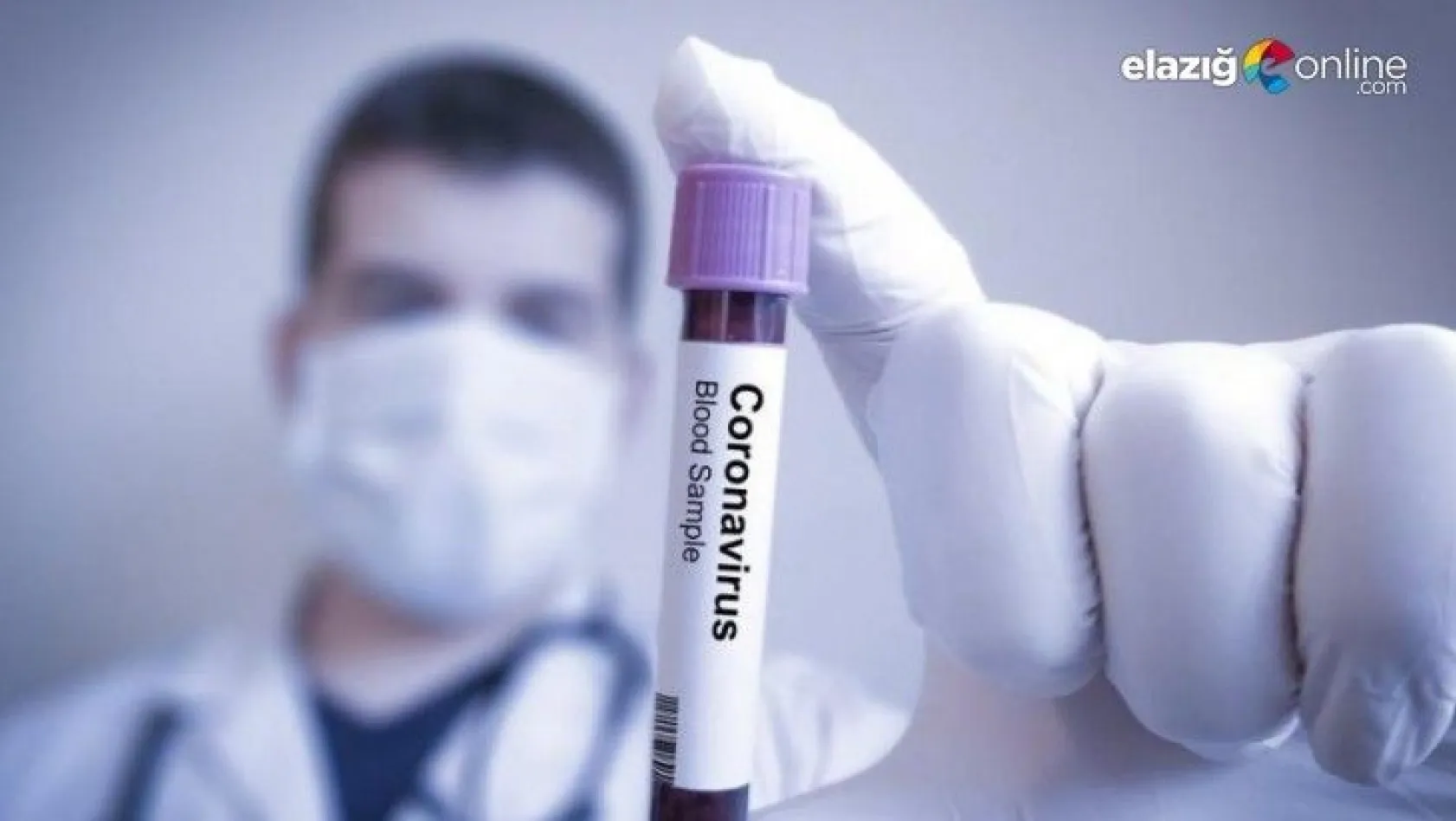 Koronavirüse karşı aşılardan daha etkili, Anında antikor geliştiriyor!
