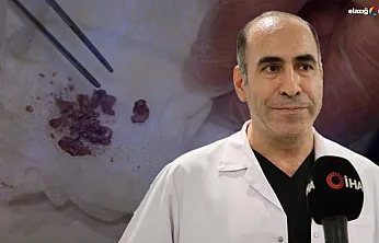 Yıllar sonra ortaya çıktı: Elazığ'da burun ameliyatında taş sürprizi