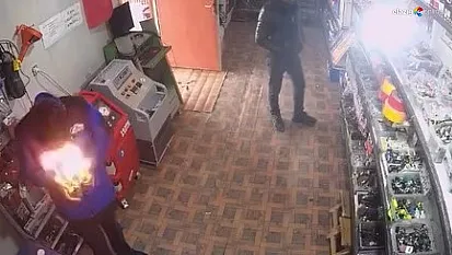 Yüzü Bir Anda Alevler İçinde Kaldı!