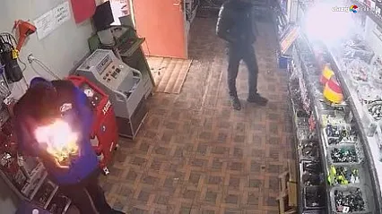 Yüzü Bir Anda Alevler İçinde Kaldı!