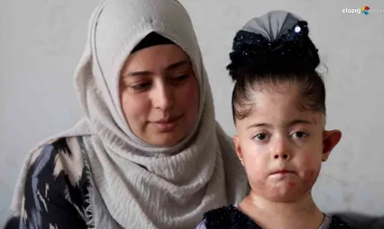 Kelebek hastası 7 yaşındaki Fatma Aydın yardım bekliyor!