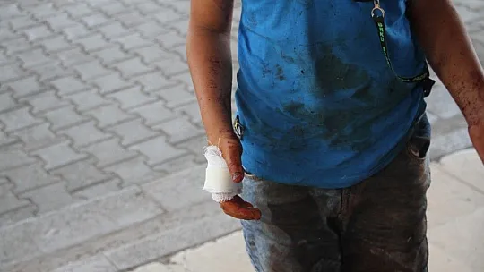 Babasına yardım etmeye çalışan çocuk elini kesti