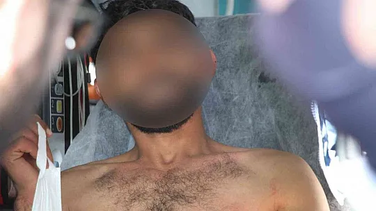 Şüpheli şahıs bacadan binaya girmeye çalışınca sıkıştı