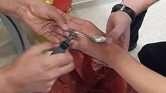 Elazığ itfaiyesinden yüzük çıkarma operasyonu