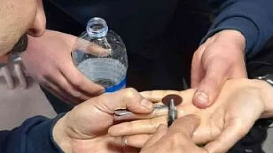 Elazığ itfaiyesinden yüzük operasyonu
