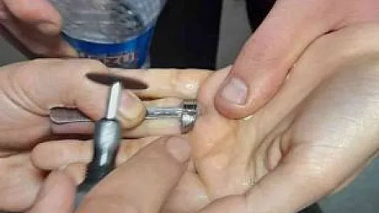 Elazığ itfaiyesinden yüzük operasyonu