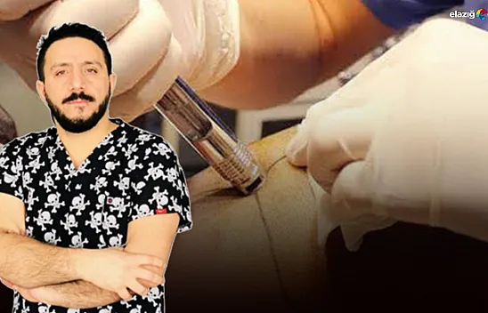 Hiç acı hissetmeden saç ekimi mümkün mü? Uzman Dağdelen cevapladı!