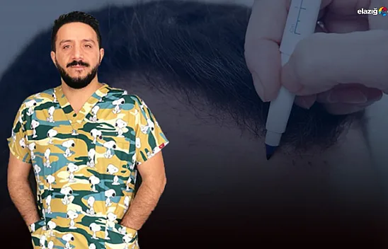 Uzman Dağdelen cevapladı! Saç ekiminde doğal görünüm nasıl elde edilir?