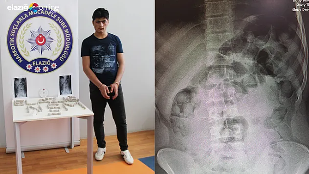 İranlı kuryenin midesinden eroin çıktı