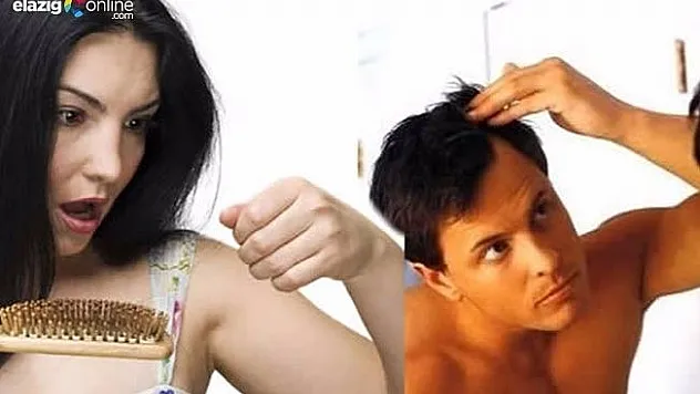 Saçlarınız mevsim geçişlerinde dökülebilir!