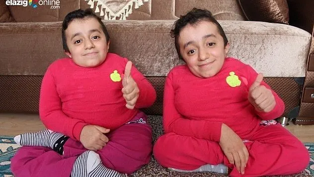 ''Birinin kemiği kırılınca diğeri de hissediyor''