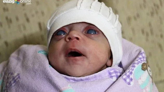 Minik İkranur, Destek Bekliyor!