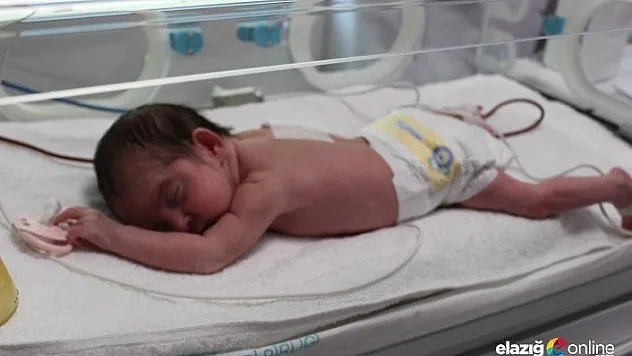 Doğduktan 16 saat sonra yapılan &quotyemek borusu&quot ile hayata tutundu