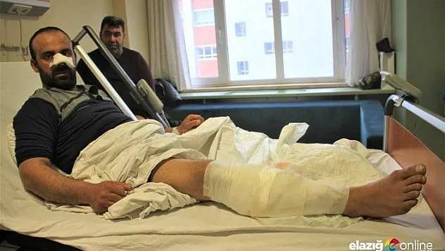 Köpekler saldırdı, burnunu ve bacağını parçaladı