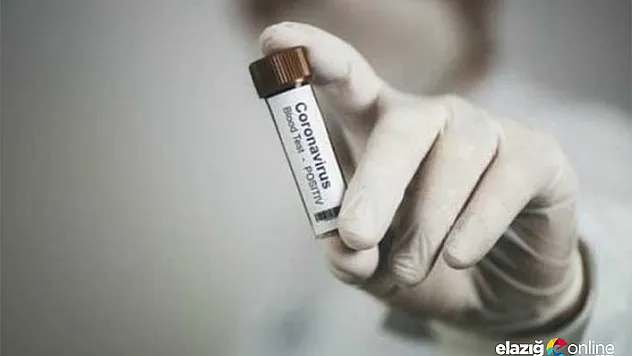 ABD'nin sağlık sektörü dökülüyor! 30 bin istendi 400 adet gönderildi...