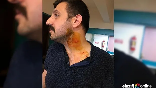 Hasta yakını, sağlık çalışanını ısırıp, darp etti