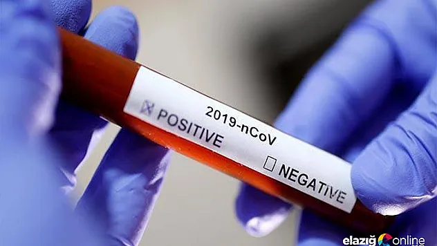 4 soruda korona virüs testi