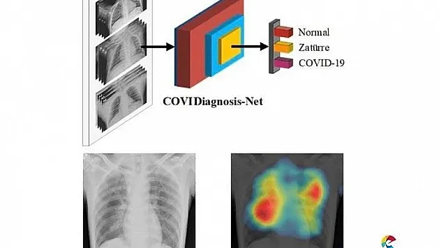 Korona virüs teşhisini kolaylaştıracak yapay zeka sistemi