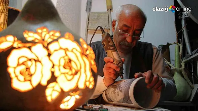 Edindiği hobi sayesinde hayata tutundu