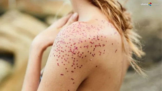 Ciltte tavuk derisi görünümüne son! Keratosis Pilaris için en iyi tedavi yöntemleri