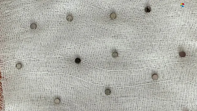 Çocuğun Midesinden 19 Mıknatıs Çıkarıldı: Elazığ'da Nefes Kesen Operasyon!