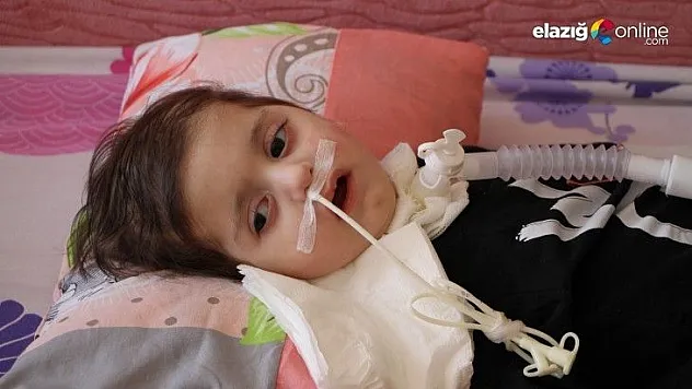 Efe bebeğin tedavisi için 2.2 milyon dolar gerekli