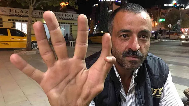 46 yaşındaki 11 parmaklı adam görenlerin dikkatini çekiyor!