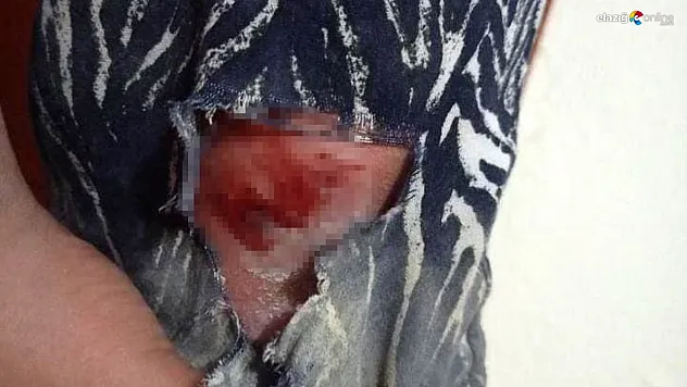 Elazığ'da başıboş köpekler dehşet saçtı! Canını zor kurtardı