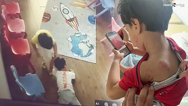 Elazığ'da bir kreşte skandal: 3 yaşındaki çocuk darp edildi, görevliler ortada yok