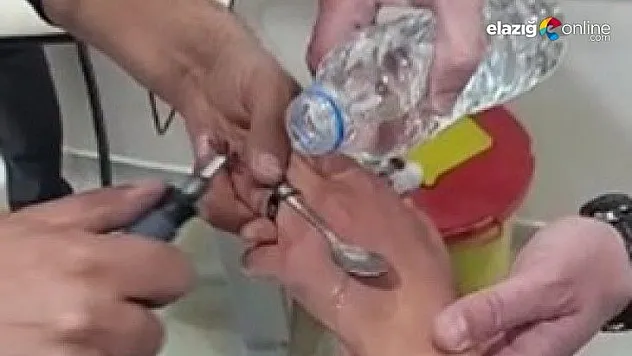 Elazığ itfaiyesinden yüzük çıkarma operasyonu