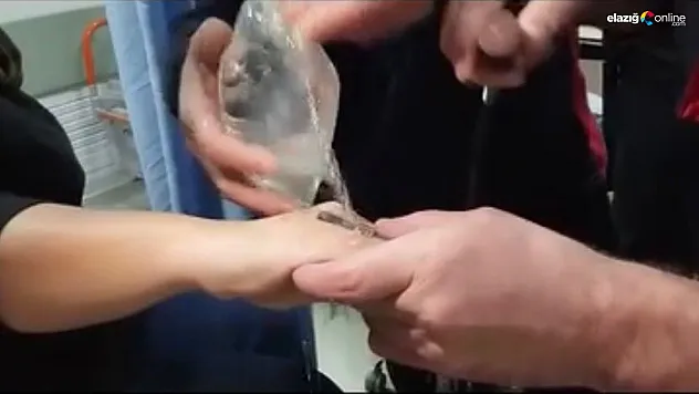 Sıkışan yüzüğü itfaiye ekipleri çıkardı