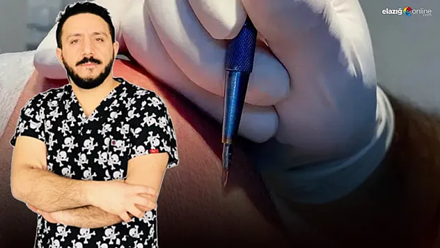 Elazığ'da yeni saç ekim yöntemi: 'Safir FUE saç ekimi'