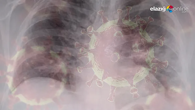 Koronavirüs akciğerleri bu hale sokuyor