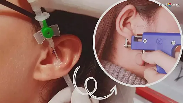 Kulak deldirme nasıl yapılır ve ağrıyı en aza indirme yöntemleri!