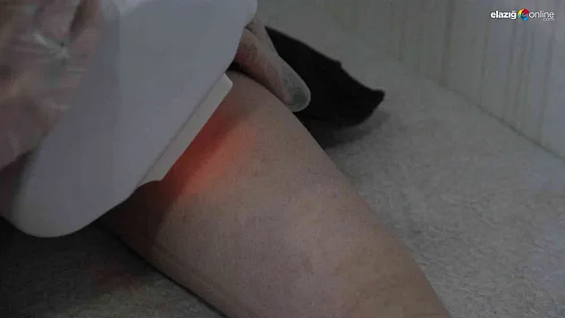 Lazer kadının vücudunu yakmıştı, başka bir güzellik uzmanı tedavisini üstlendi