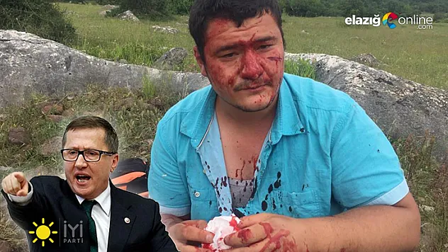 Meslektaşımıza Çirkin Saldırı