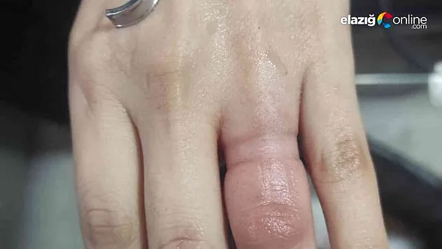 Elazığ itfaiyesinden yüzük operasyonu