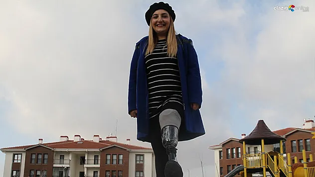 Sol bacağı olmadan dünyaya geldi, engelin engel olmadığını kanıtladı