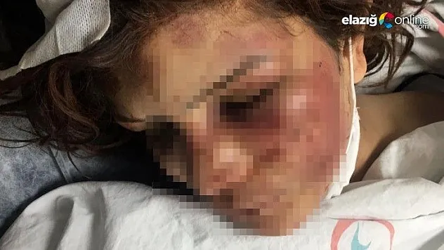 Urfa'da Kan Donduran Olay!