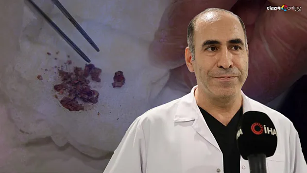 Yıllar sonra ortaya çıktı: Elazığ'da burun ameliyatında taş sürprizi
