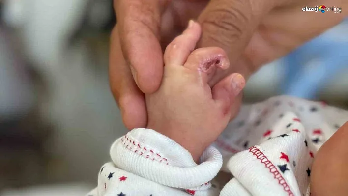 2 aylık Ömer bebeğin tedavi gördüğü hastane kabusu oldu