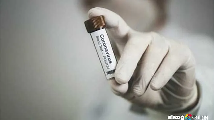 ABD'nin sağlık sektörü dökülüyor! 30 bin istendi 400 adet gönderildi...