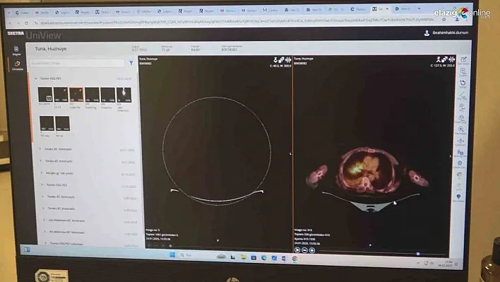 Beslenme biçimi ve yaşam tarzı kanser hastalığını tetikliyor