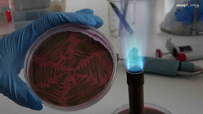 Çiğ süt, gıdayla bulaşan idrar yolu enfeksiyonlarına kapı açıyor