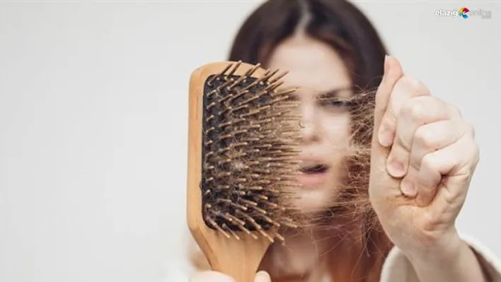 Kadınlarda erkek tipi saç dökülmesinin sebepleri ve etkili tedavi yöntemleri