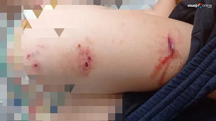 Sokak köpekleri faciaya neden oluyordu: Komşular yetişmeseydi parçalayacaklardı