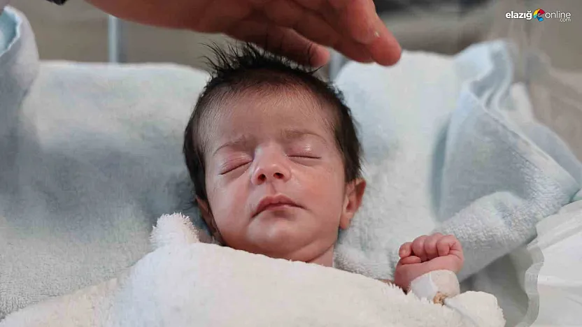 Urfa'da kapılar kapandı, şifa Elazığ'da bulundu: Ada bebek hayata 'merhaba' dedi